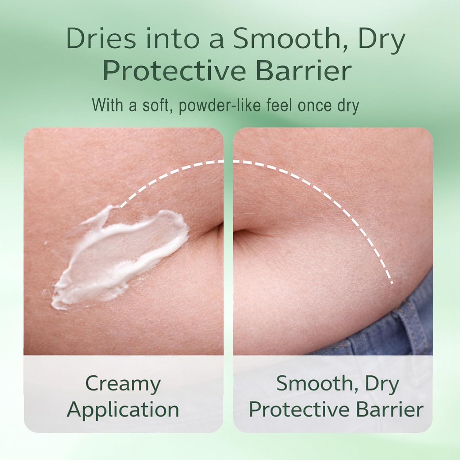1Ps Intertrigo Cream – Skin Fold Barrier Cream for Moisture & Friction Protection, Helps Support Skin Comfort, Fast-Drying Non-Greasy Formula for Friction-Prone Areas.